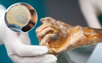 Microbioma Otzi