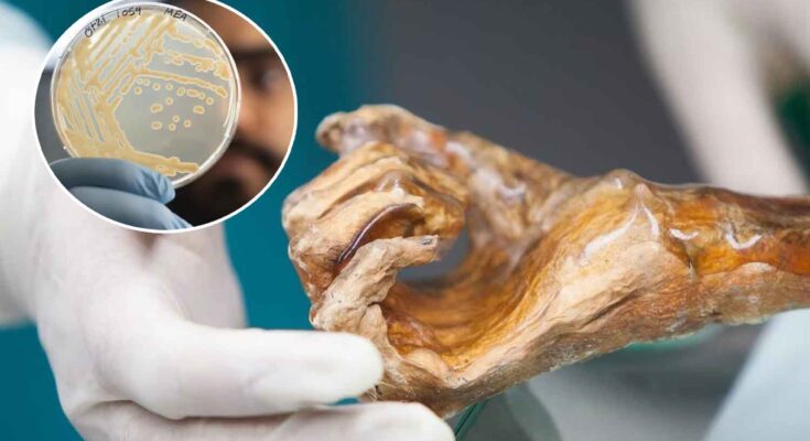 Microbioma Otzi