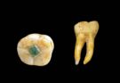 Otturazioni dentali dei Maya: precisione antica e pietre preziose