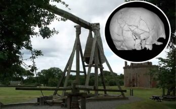 scheletro con 167 fratture trovato a Stirling