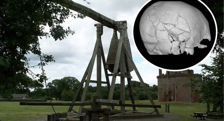 scheletro con 167 fratture trovato a Stirling